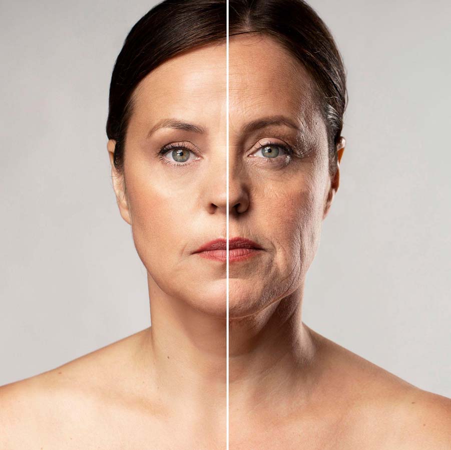 Collagen Boosting Treatments for Skin Tightening